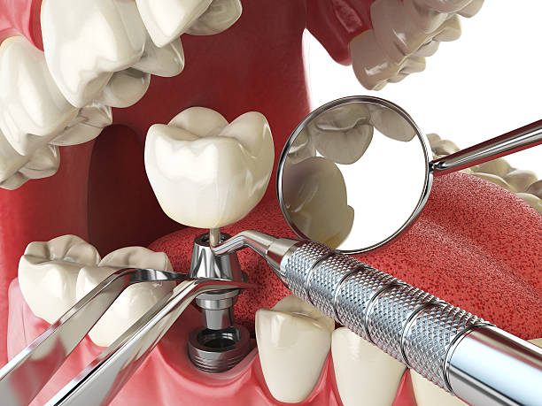Best Walk-In Emergency Dentist in Oak Lawn, IL